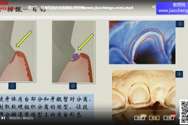 汉尔思社群课丁淑香贴面修复训练营视频课程15集百度网盘下载学习