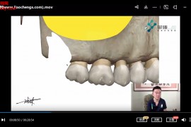 2021年张林微创拔牙视频课程百度网盘下载学习