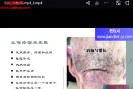 靳庆东靳氏截针进阶班视频课程72集百度网盘下载学习