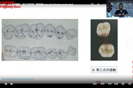 林崇运排牙跟训实操视频课程20集百度网盘下载学习