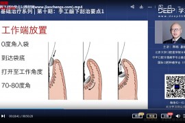 2a洗牙视频课程合集孙洲洗牙洗牙结治释栋口腔牙周基础治疗洗牙教程百度网盘下载学习