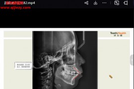 陈宠25年正畸接诊实录视频课程99集百度网盘下载学习