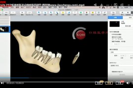 由民昕DSD与Keynote在口腔医学中的应用视频课程6集百度网盘下载学习