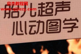 何怡华著胎儿超声心动图学电子书pdf百度网盘下载学习
