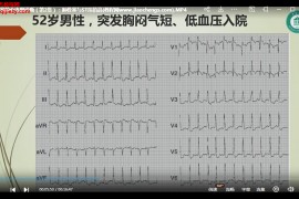 北京大学航天中心医院赵运涛肺栓塞心电图诊断视频课程3集百度网盘下载学习