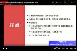 2020年章晶晶前牙反颌的早期矫正与生长考量视频课程12集百度网盘下载学习