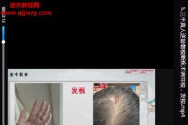 王哲三丰真人逆龄磐根断疾术视频课程6集百度网盘下载学习