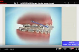 汉尔思陈宠正畸技巧运用和动画演示视频课程56集百度网盘下载学习