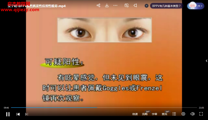 耳石症.png