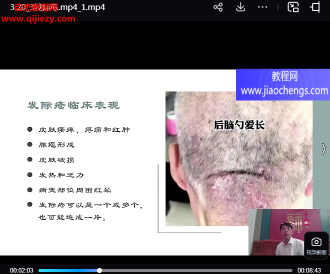 靳慶東靳氏截針進(jìn)階班視頻課程72集百度網(wǎng)盤下載學(xué)習(xí)