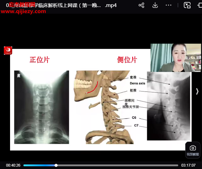 祁獻(xiàn)靈疼痛影像學(xué)臨床解析線上網(wǎng)課3天視頻課程百度網(wǎng)盤下載學(xué)習(xí)