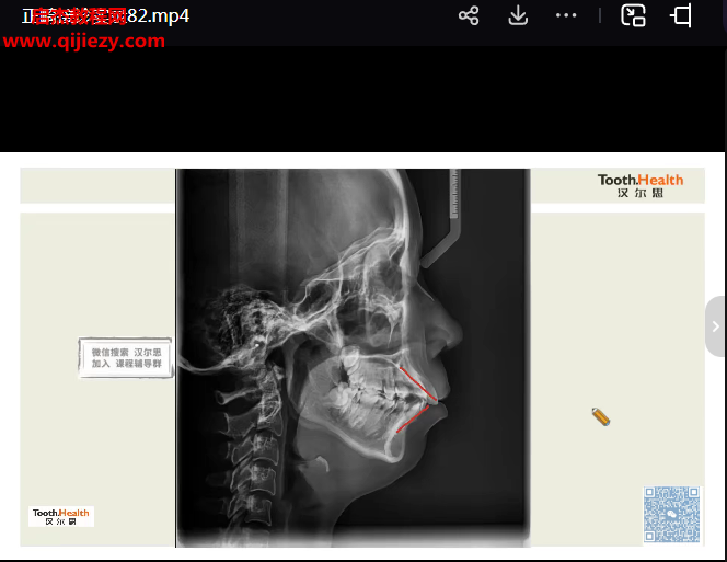 正畸接诊实录.png 正畸接诊实录.png